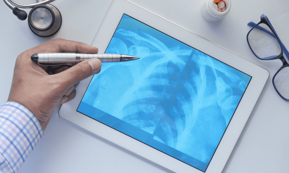 médico contando com a radiologia digital