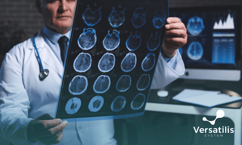 lítio impacta doença de alzheimer