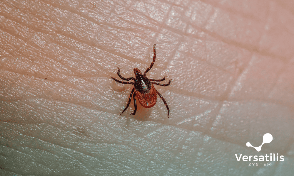 alergia rara transmitida por carrapato